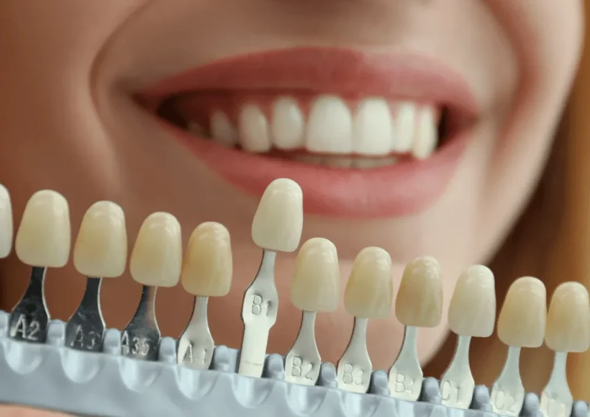 cosmetic-dentistry-image