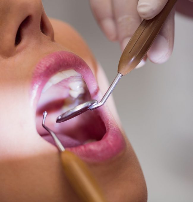 Close up of dentist examining female patient teeth