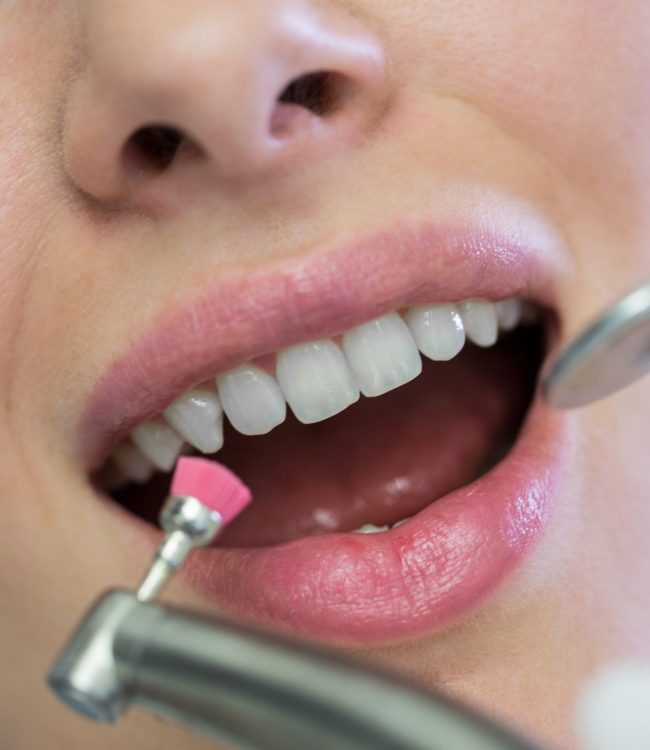Dentist examining a female patient with tools at dental clinic