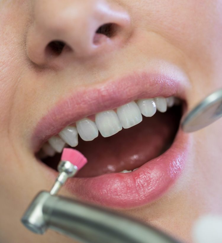 Dentist examining a female patient with tools at dental clinic