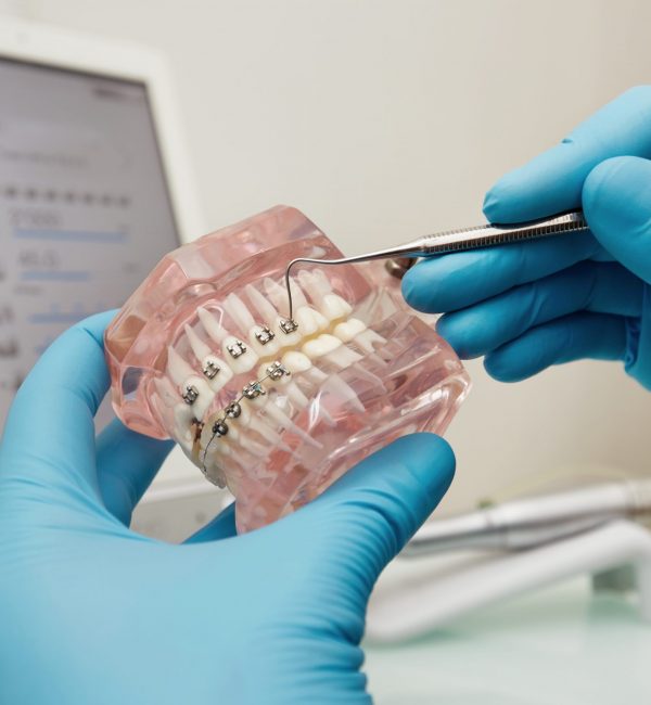 Prosthetics hands while working on the denture, false teeth, a study and a table with dental tools. Dental laboratory.